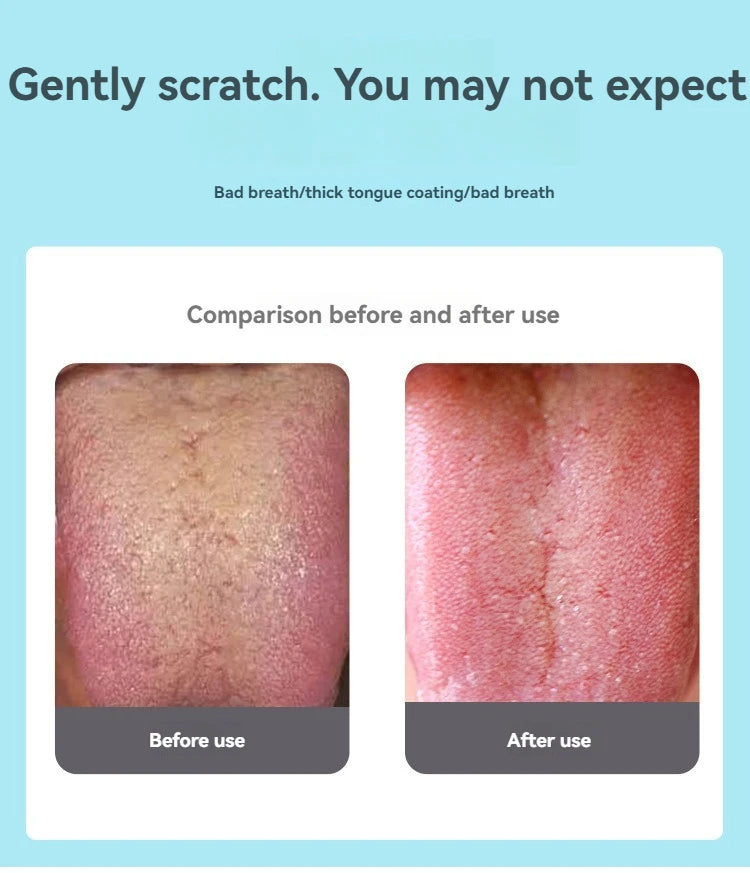 U-shaped Tongue Scraper Tongue Coating CleaningScraper Remove Bad Breath Bring Fresh Breath For Oral Suitable Men And Women