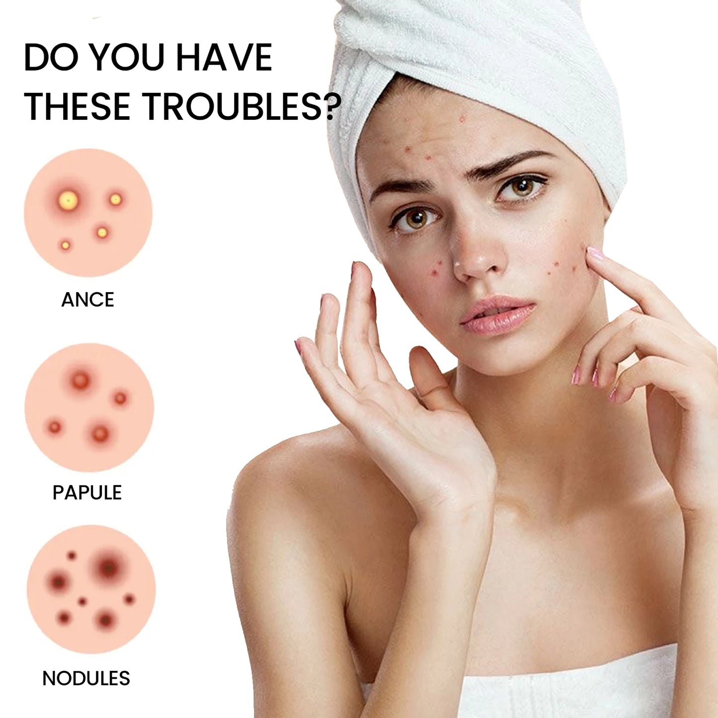 200Pcs Repair Acne Patch Fade Blemishes Pimple Marks Closed Acne Blemishes Hydrocolloid Star Shaped Cover Acne Pimple Patch